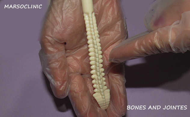 bone and joint