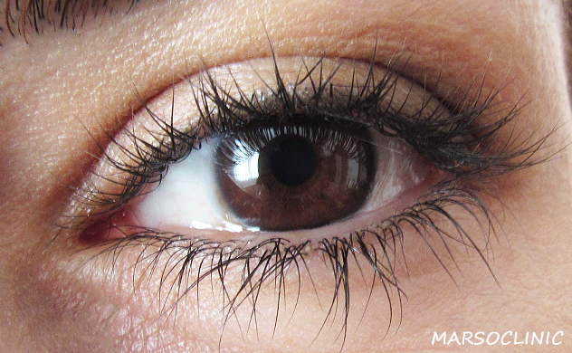 eye