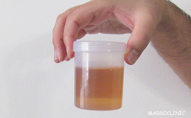 Is urine sterile