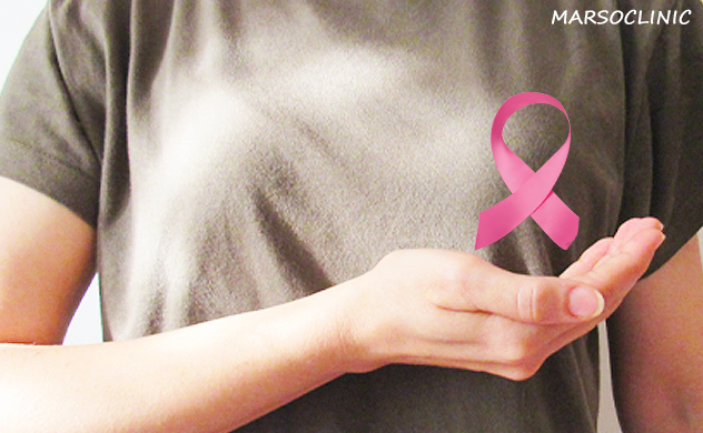 The major causes of breast cancer almost everyone ignores