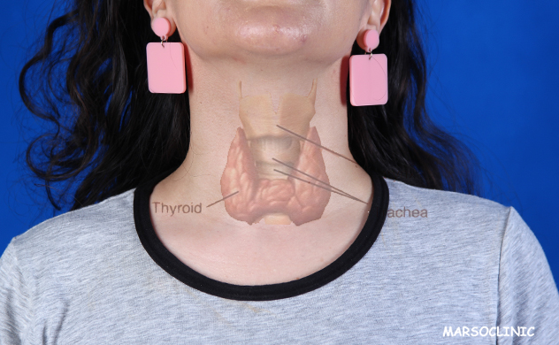 -thyroid cancer treatment radioactive iodine